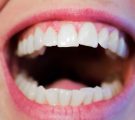 How to look after your voice